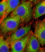 AKT2 Antibody in Immunocytochemistry (ICC/IF)