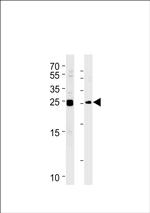 MOB4A Antibody in Western Blot (WB)