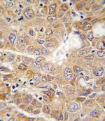 PGK1 Antibody in Immunohistochemistry (Paraffin) (IHC (P))