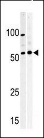 PKMYT1 Antibody in Western Blot (WB)