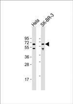 AMPK alpha-1 Antibody in Western Blot (WB)