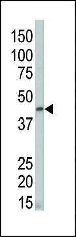 DAPK2 Antibody in Western Blot (WB)