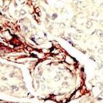 LKB1 Antibody in Immunohistochemistry (Paraffin) (IHC (P))