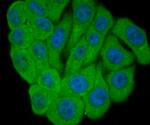 ALDH1A1 Antibody in Immunocytochemistry (ICC/IF)