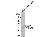 Beclin 1 Antibody in Western Blot (WB)