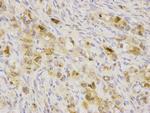 SQSTM1 Antibody in Immunohistochemistry (Paraffin) (IHC (P))