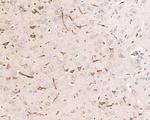 P-Glycoprotein Antibody in Immunohistochemistry (Paraffin) (IHC (P))