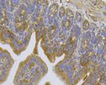 TRPV6 Antibody in Immunohistochemistry (Paraffin) (IHC (P))