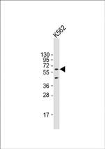 AMPK alpha-1 Antibody in Western Blot (WB)