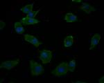 DDX3 Antibody in Immunocytochemistry (ICC/IF)