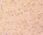 NME1 Antibody in Immunohistochemistry (Paraffin) (IHC (P))