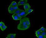 NOX2 Antibody in Immunocytochemistry (ICC/IF)