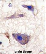 NPTX1 Antibody in Immunohistochemistry (Paraffin) (IHC (P))