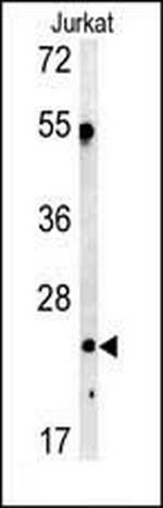 C1QA Antibody in Western Blot (WB)