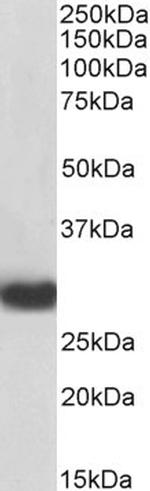 MyD88 Antibody in Western Blot (WB)