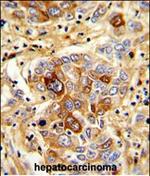 CD163 Antibody in Immunohistochemistry (Paraffin) (IHC (P))