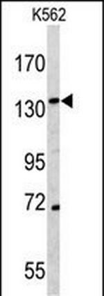 CD163 Antibody in Western Blot (WB)