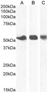 ENT1 Antibody in Western Blot (WB)