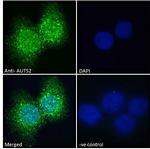 AUTS2 Antibody in Immunocytochemistry (ICC/IF)