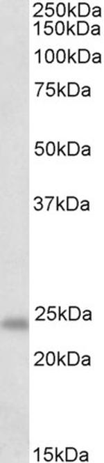 GM2A Antibody in Western Blot (WB)