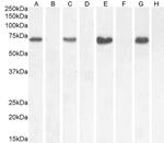 NOX1 Antibody in Western Blot (WB)