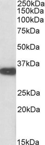 Aspartoacylase Antibody in Western Blot (WB)