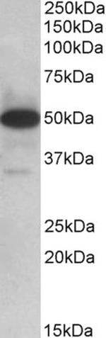 TXNDC5 Antibody in Western Blot (WB)