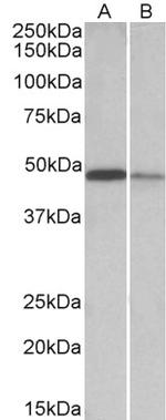 TXNDC5 Antibody in Western Blot (WB)