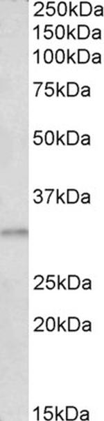 AES Antibody in Western Blot (WB)