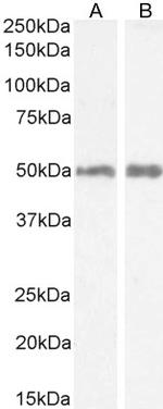 HRH2 Antibody in Western Blot (WB)