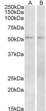 VIPR1 Antibody in Western Blot (WB)