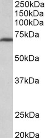 MTHFR Antibody in Western Blot (WB)