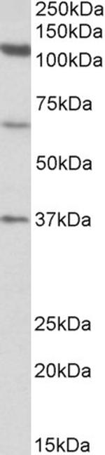 CP110 Antibody in Western Blot (WB)