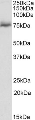 NUMBL Antibody in Western Blot (WB)