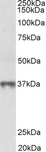 MAT2B Antibody in Western Blot (WB)