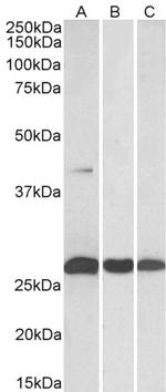 MKP3 Antibody in Western Blot (WB)