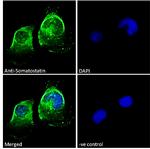 pro-Somatostatin Antibody in Immunocytochemistry (ICC/IF)