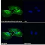 pro-Somatostatin Antibody in Immunocytochemistry (ICC/IF)