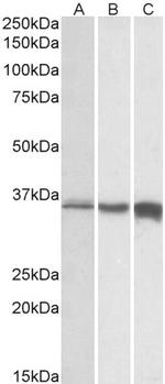 TNNT3 Antibody in Western Blot (WB)