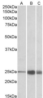 TNNI2 Antibody in Western Blot (WB)