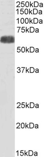 YLAT2 Antibody in Western Blot (WB)