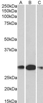 HOXA5 Antibody in Western Blot (WB)