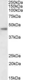 Carbonic Anhydrase XII Antibody in Western Blot (WB)