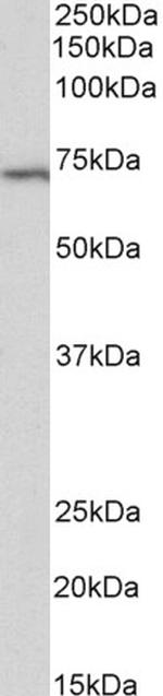 TRIF Antibody in Western Blot (WB)