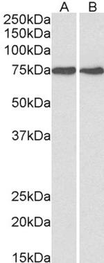 GRP78 Antibody in Western Blot (WB)