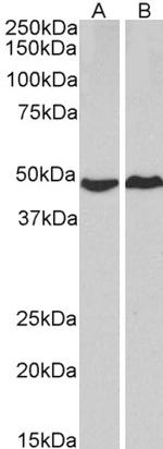 PKA alpha Antibody in Western Blot (WB)