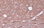 Phospho-PKC epsilon (Ser729) Antibody in Immunohistochemistry (Paraffin) (IHC (P))