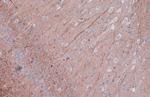 Phospho-PKC epsilon (Ser729) Antibody in Immunohistochemistry (Paraffin) (IHC (P))