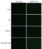 Zika Virus NS1 (strain H/PF/2013) Antibody in Immunocytochemistry (ICC/IF)
