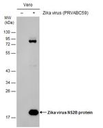 Zika Virus NS2B (strain H/PF/2013) Antibody in Western Blot (WB)